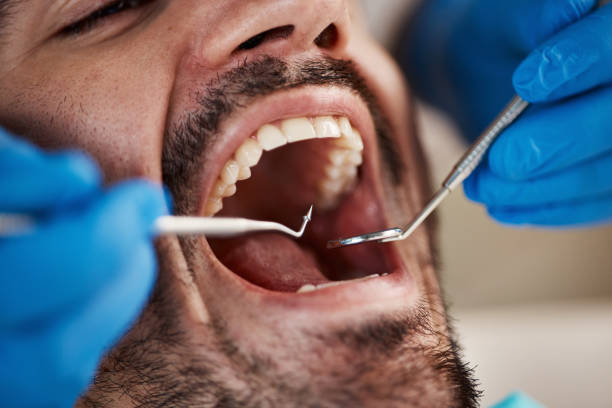 Best Cracked Tooth Emergency Dentist  in Oakbrook, KY